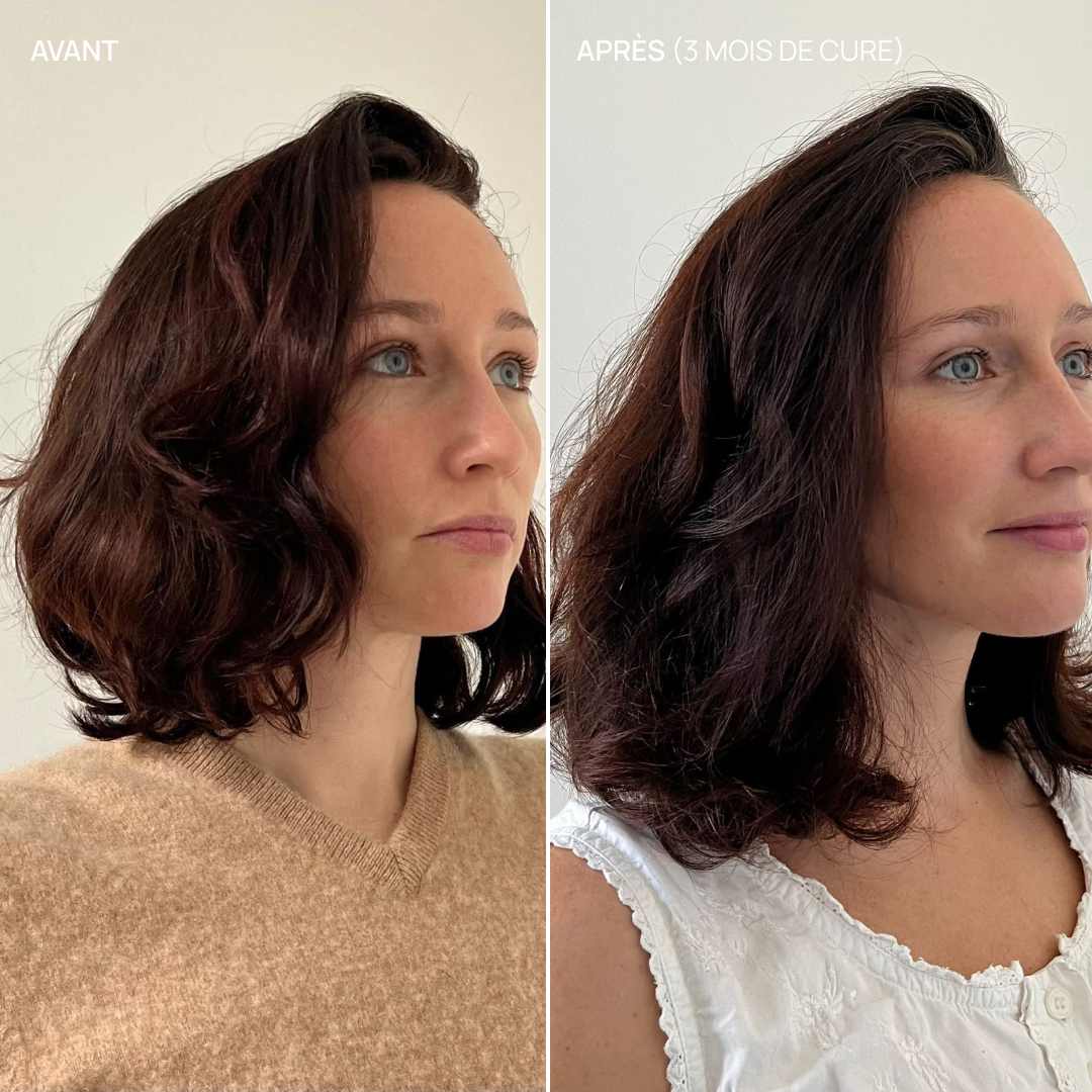Complément alimentaire cheveux, Hair & Scalp Boost - Image 6
