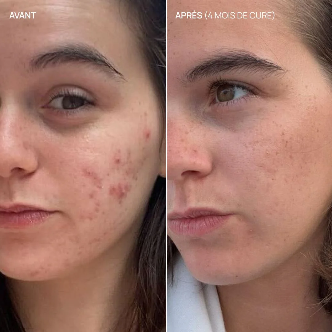 Complément alimentaire imperfections, Pure Glow - Image 7